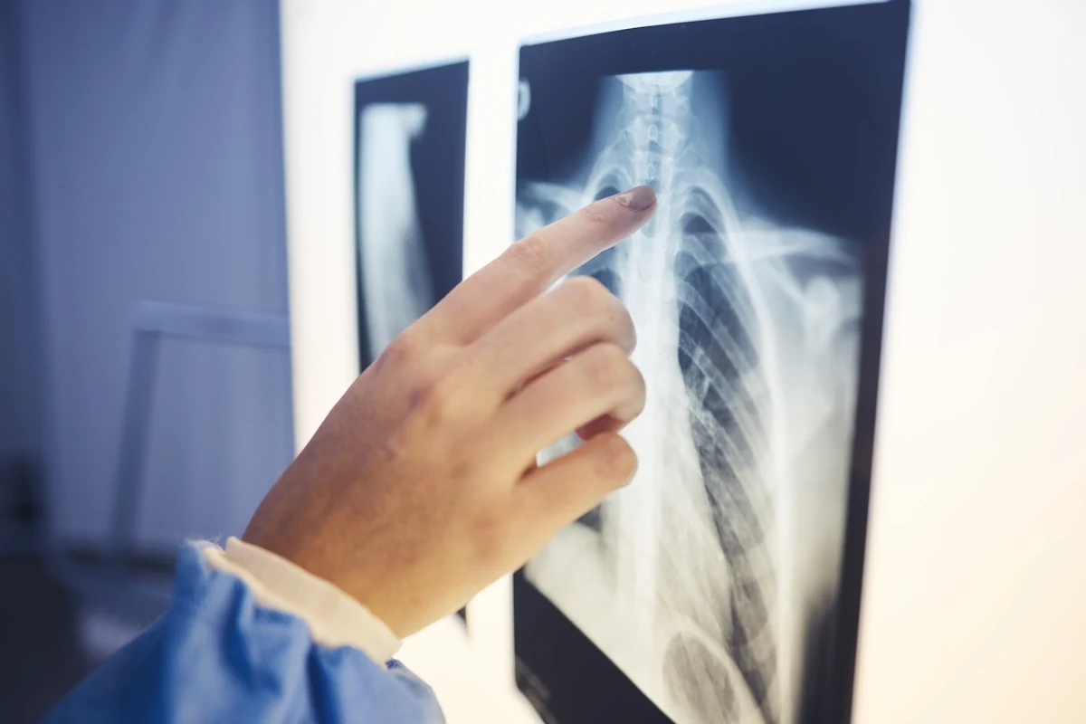 Une main qui montre une radiographie épaule